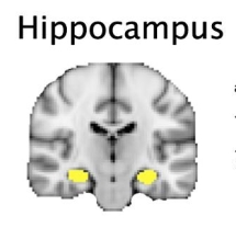 Hippocampus - geel blokje op de scan