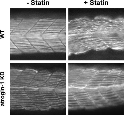 Statines and muscle damage